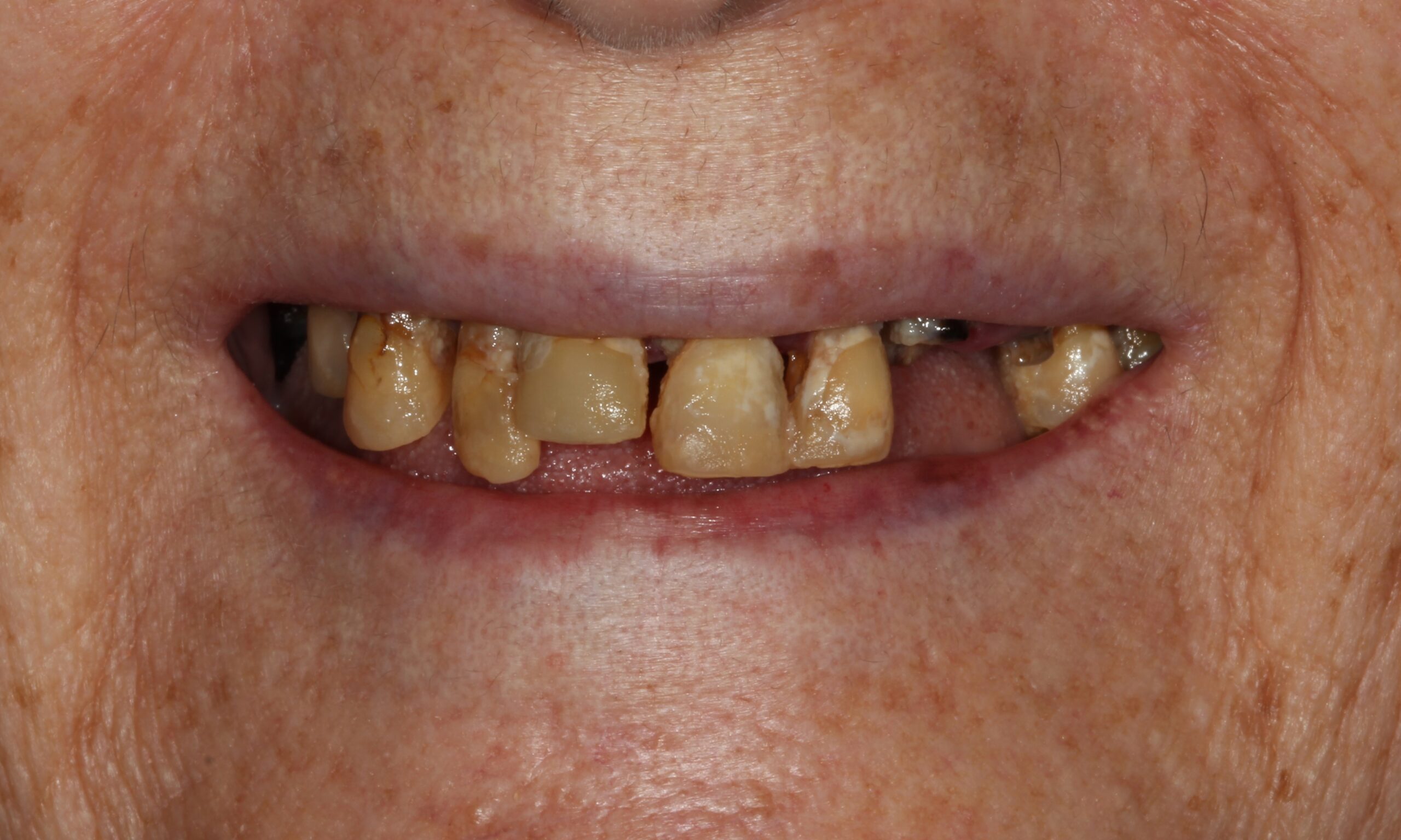 Before treatment