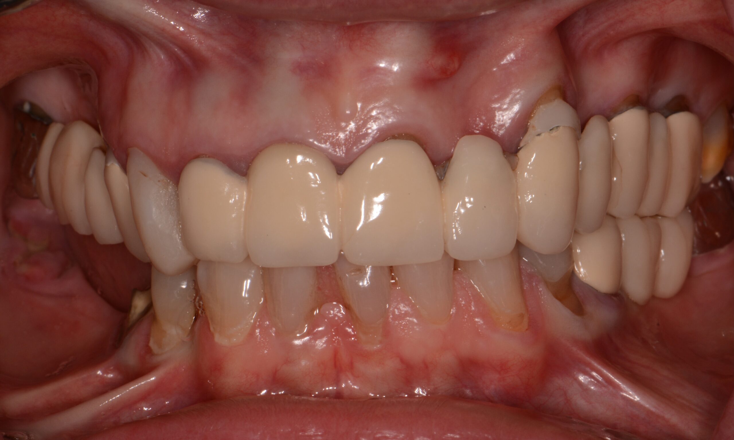 Before treatment
