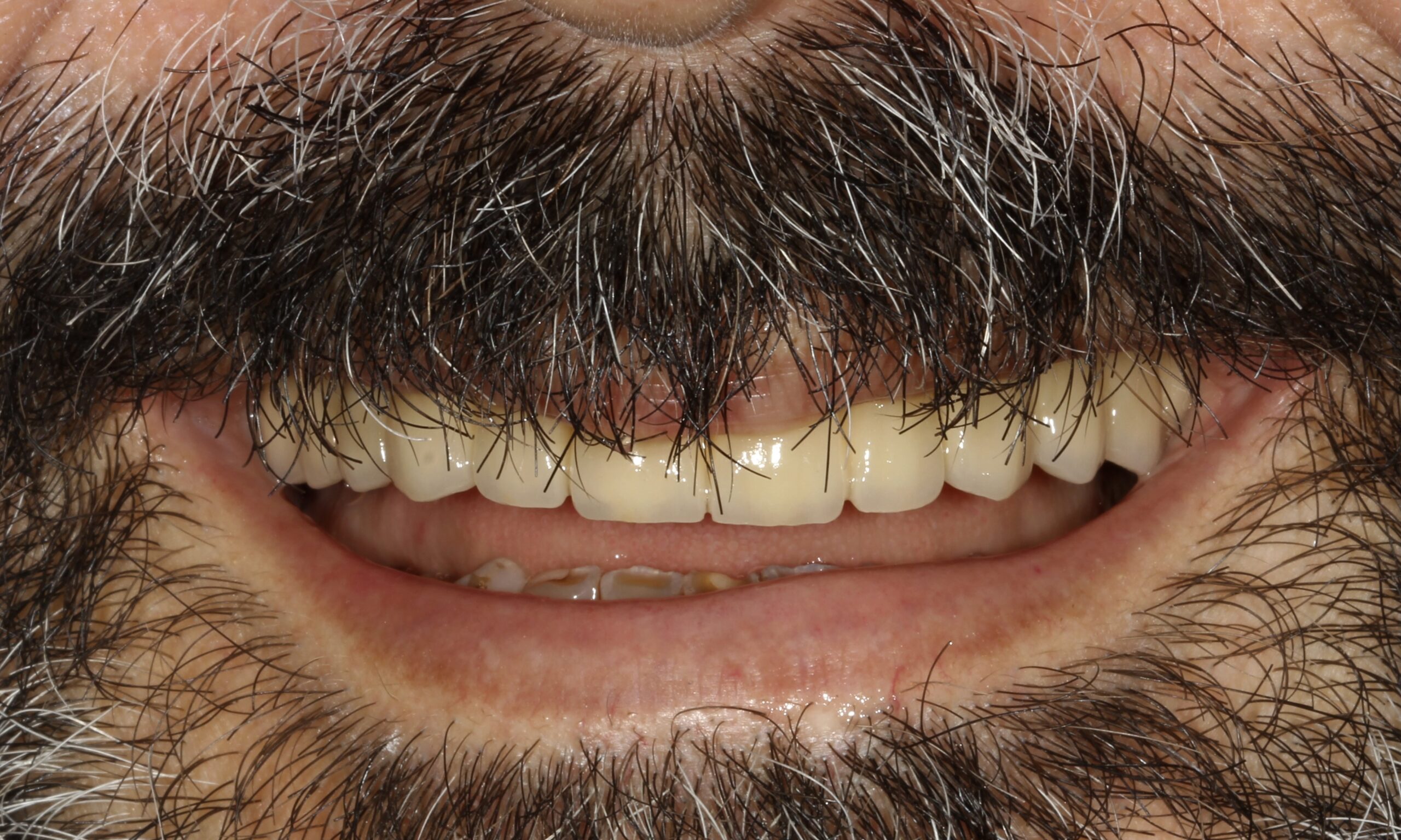 After treatment