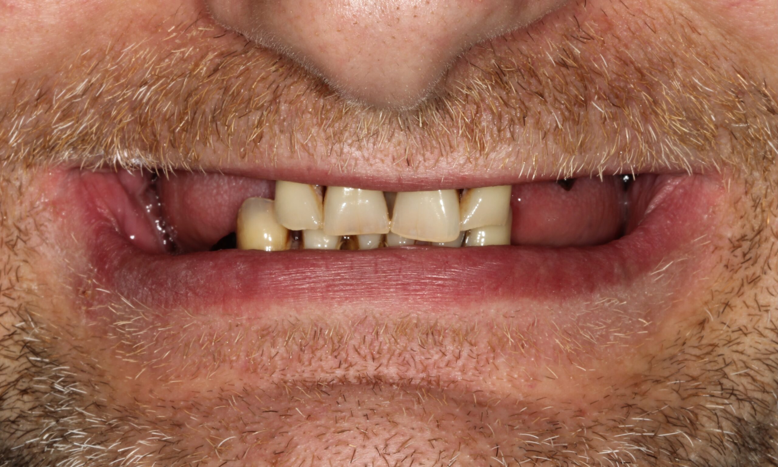 Before treatment