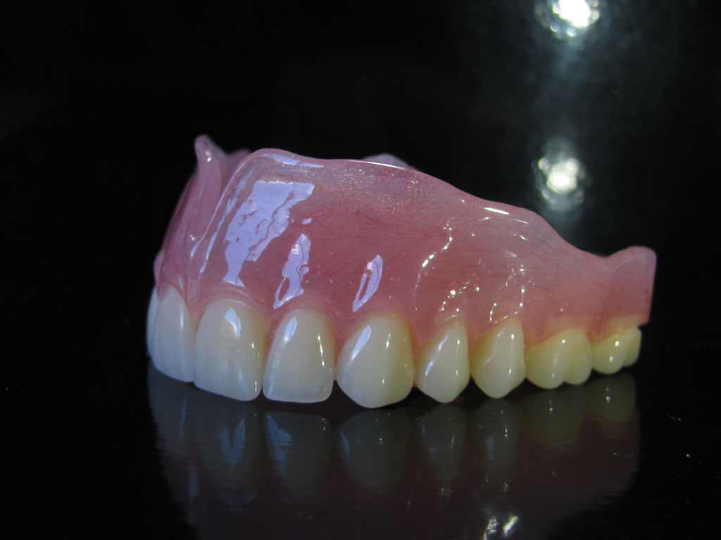 acrylic-full-dentures-3
