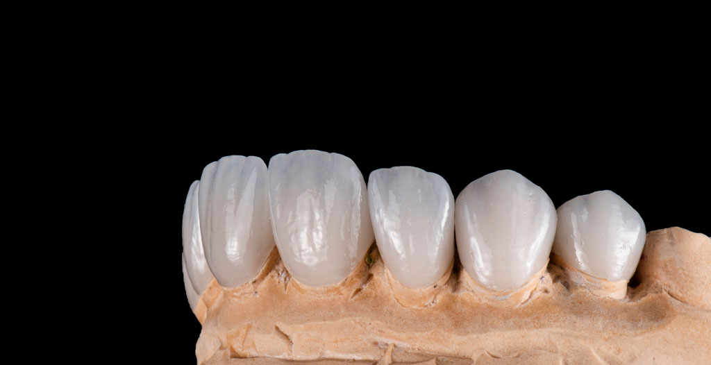 full-ceraminc-1